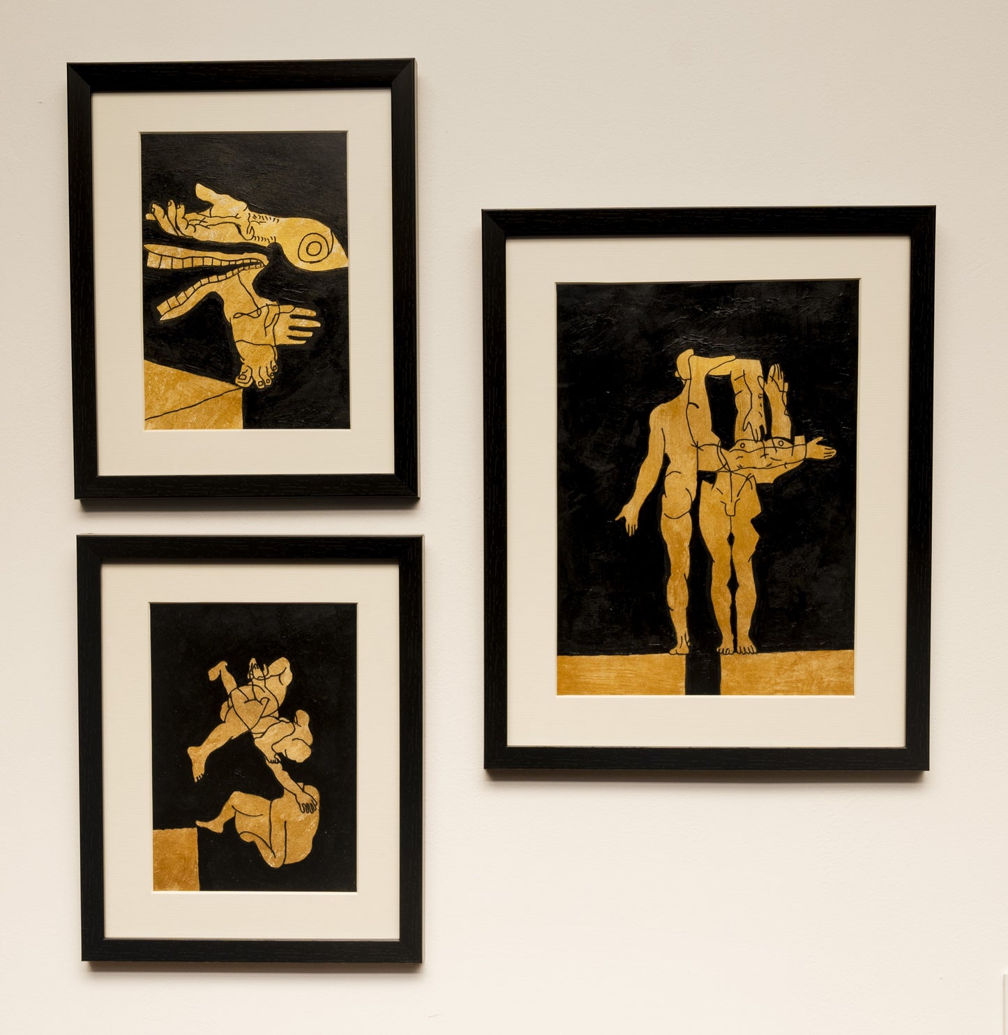Untitled 20 (Anatomical Error Series)